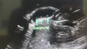 Read more about the article BATU KARANG DALAM HEMPEDU.