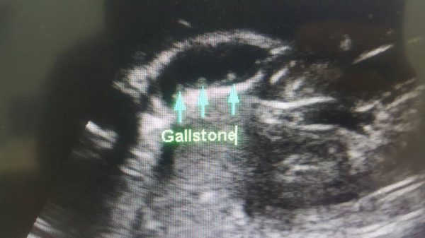 You are currently viewing BATU KARANG DALAM HEMPEDU.